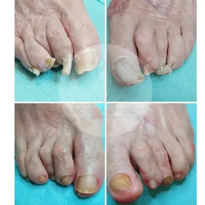 Podologia Gorzów Wielkopolski Justyna Czaja